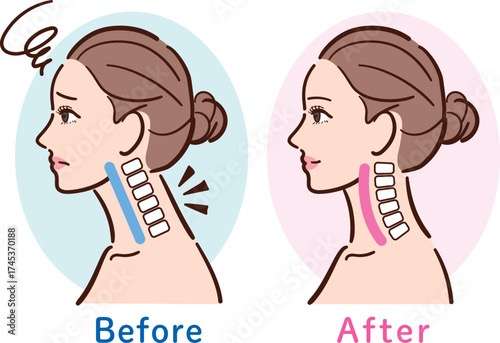 スマホ首の放置は危険です⚠️