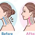 スマホ首の放置は危険です⚠️